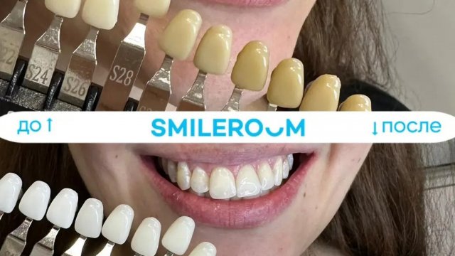 Франшиза SMILE ROOM