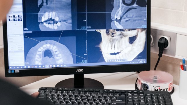 Франшиза Dental Way