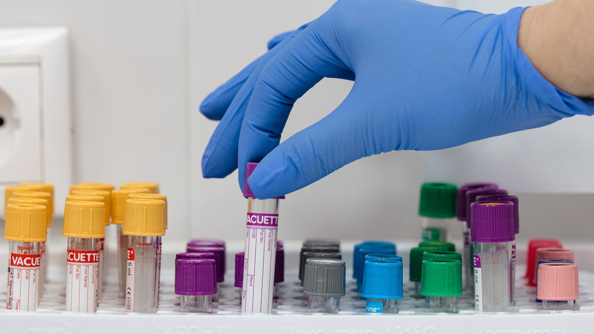 франшиза KDL