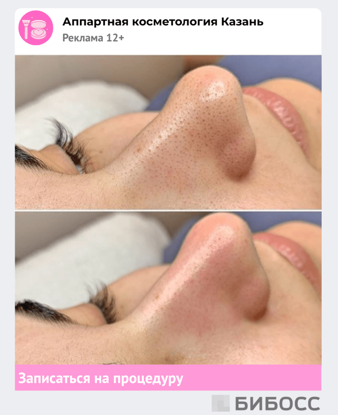 Таргетированная реклама аппаратной косметологии в социальных сетях